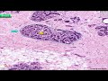 Histology of Breast: Shotgun Histology