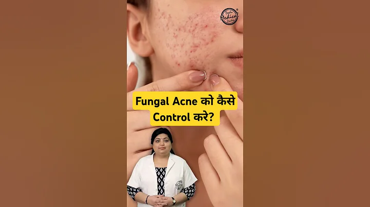 How to treat Fungal Acne on face? | Fungal Acne Treatment  #fungalacne #acne #skincare #shorts