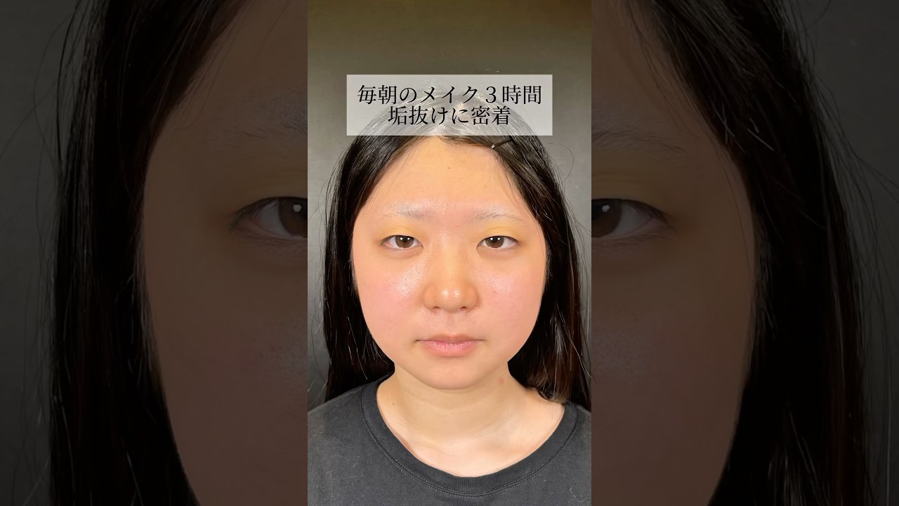 【二重整形】#shorts 垢抜けに密着