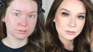 LIGHT MAKEUP GRWM | FRECKLES!