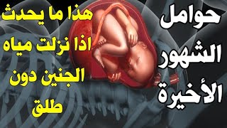 ماذا يحدث اذا انفجر كيس الجنين ونزلت المياه دون طلق وكيف تتعاملين مع هذه الوضعية