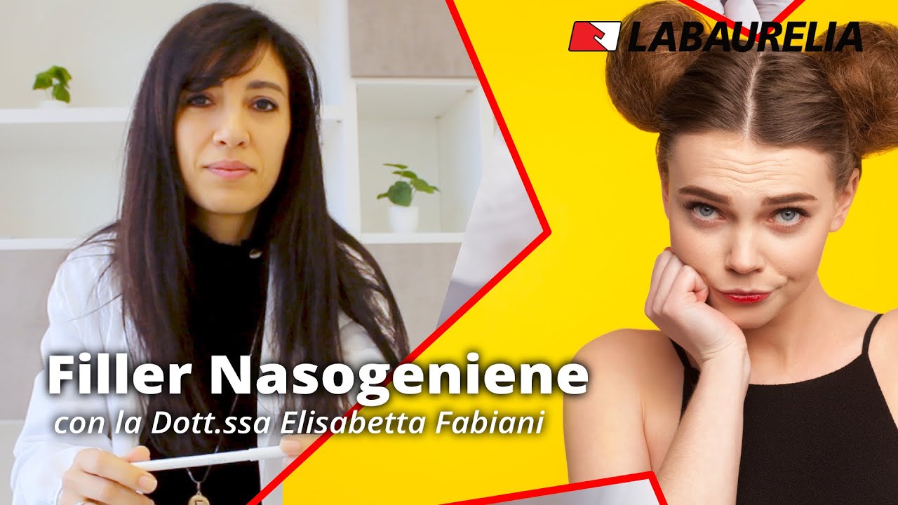 Filler rughe nasogeniene