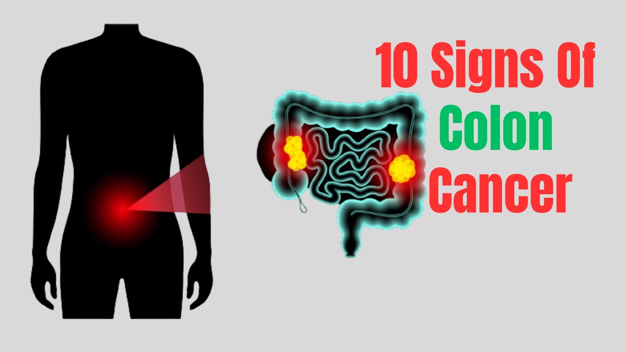 Top 10 Early Warning Signs Of Colon Cancer Colon Cancer signs YouTube