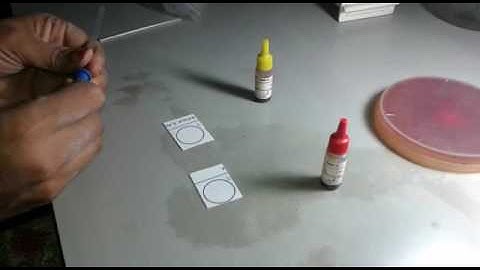 Lancifield grouping of streptococcus