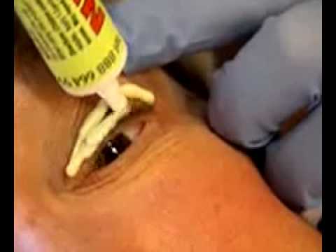 Permanent Eyeliner Pain Control by Dr Linda Dixon MD