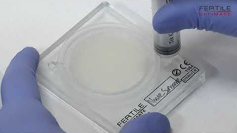 The usage of the "FERTILE ULTIMATE" microfluidic sperm sorting chip