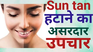 Tanning हटाने का सबसे असरदार घरेलु उपचार | Most effective tan removal home remedy