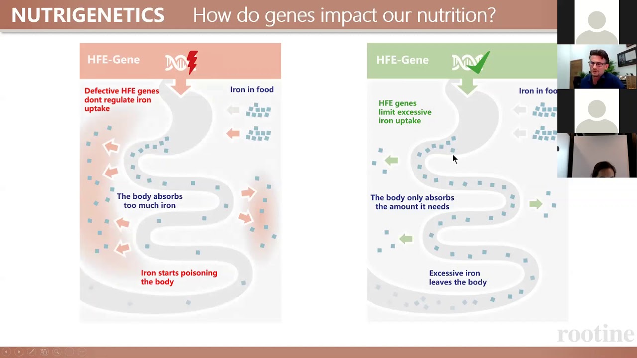 hemochromatosis gene