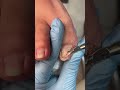 Satisfying Toenail Grooming | Gentle Foot Care Routine #fypシ #cleannails #RelaxingCare #fypシ 