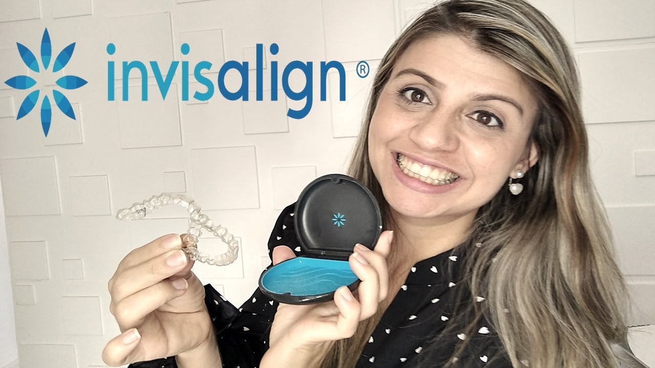 Início do meu tratamento com  o aparelho INVISALIGN