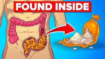 Insane Ways Drug Smugglers Tried to Get Away With It