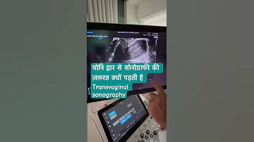 Transvaginal Sonography 