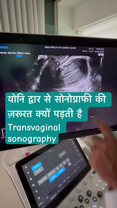 Transvaginal sonography