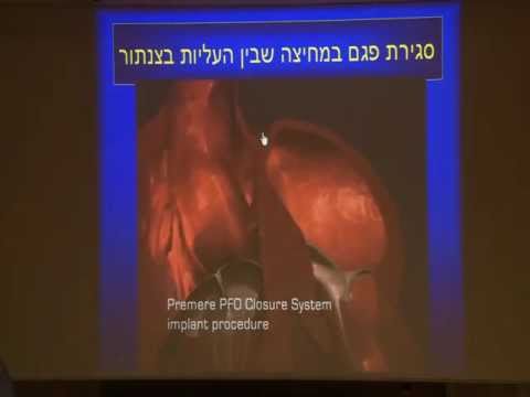 כל מה שרצית לדעת על צנתורי לב מיוחדים