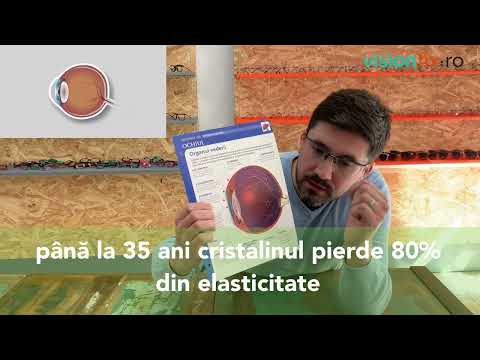 Video: Cum poate fi corectată prezbiopia?