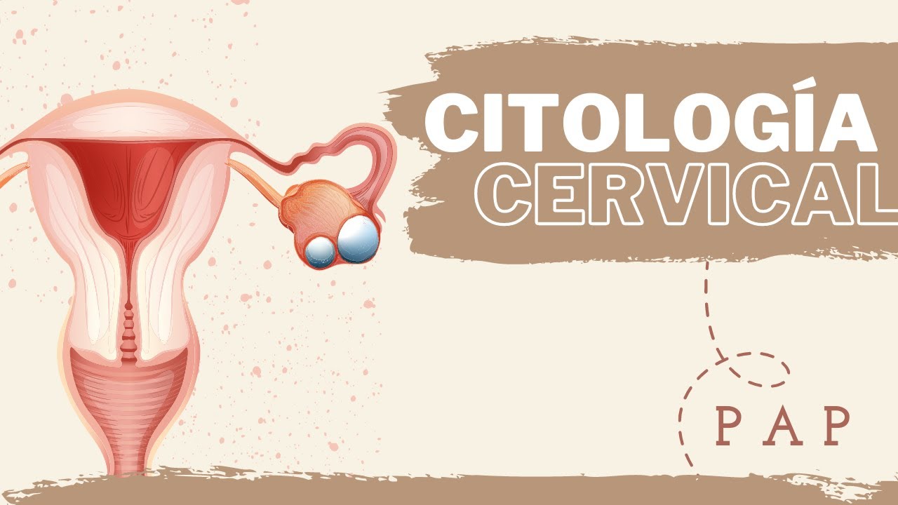 CITOLOGIA CERVICAL PROCEDIMIENTO YouTube CITOLOGIA CERVICAL PROCEDIMIENTO YouTube