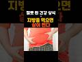 잘못된 건강상식-지방을 먹으면 살이 찐다?