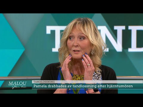 Video: Skulle jag veta om jag hade tandlossning?