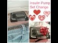 Insulin pump insertion