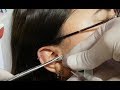 Kulak | Tragus |  Piercing Delimi İyileşme Süresi?