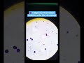 🩸Indigenous Plasmodium malariae under the microscope.🔬#PlasmodiumMalariae #neet#malaria #shorts #lab