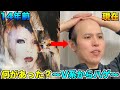 【ビジュアル系→ハゲ】ハゲがハゲる前のイケメン時代の女事情とは？