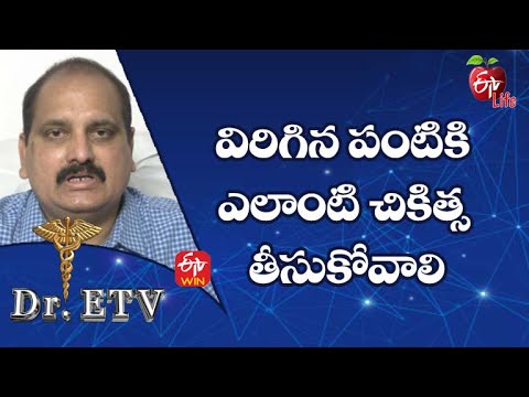 విరిగిన పంటికి ఎలాంటి చికిత్స తీసుకోవాలి| డాక్టర్ ఈటీవీ | 12th జనవరి 2022 | ఈటీవీ  లైఫ్