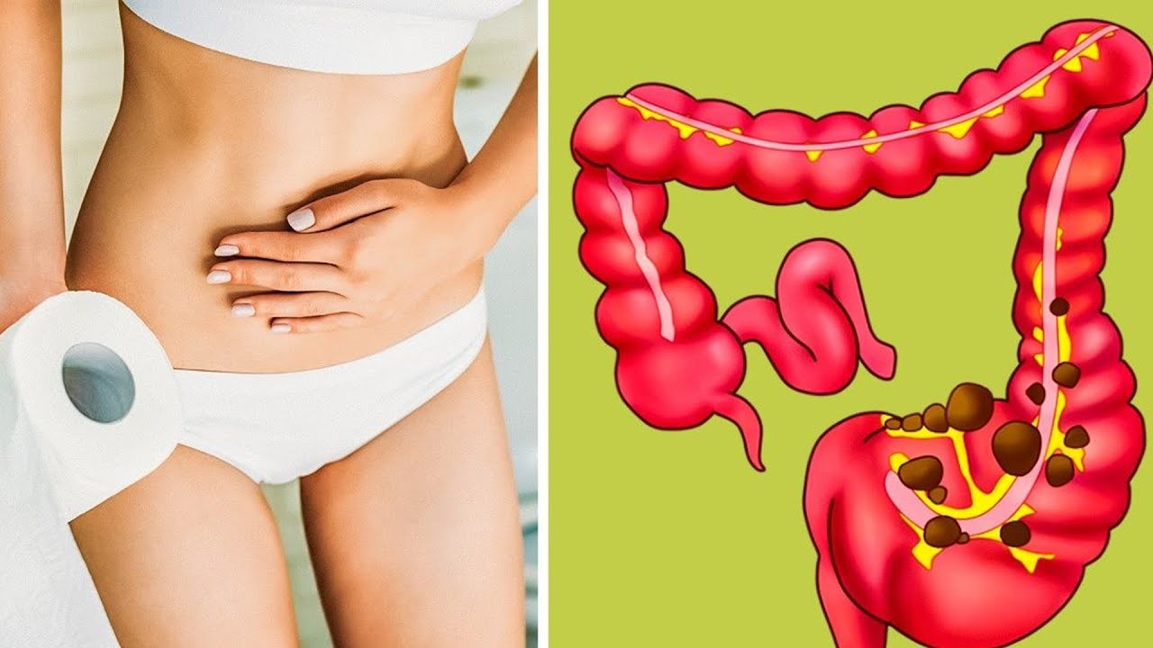 Cual es el mejor probiotico para colon irritable