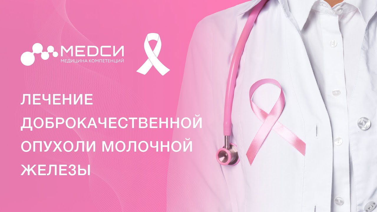 Доброкачественные новообразования груди: фиброаденомы, кисты, уплотнения, внутрипротоковые папилломы