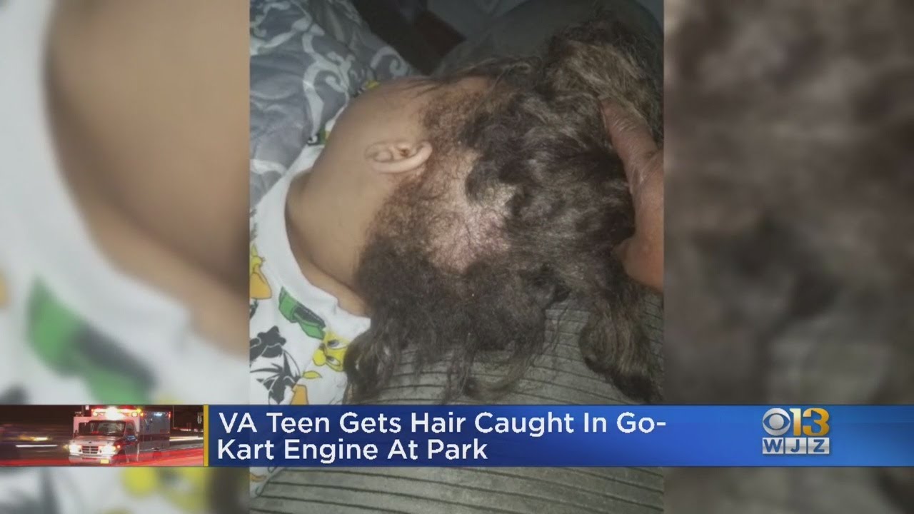 Teen Thought She Was Going To Die After Her Hair Got Caught In Go Kart Engine Youtube 
