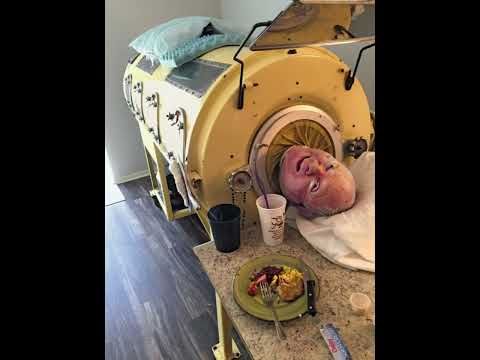 Man lived in iron lung for 70 years | incredible story of Paul Alexander | polio victim