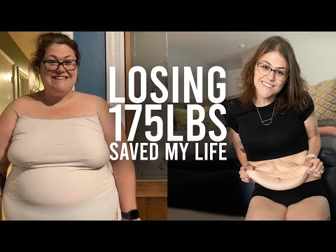 I've Been Left With 10lbs Of Excess Skin | BRAND NEW ME