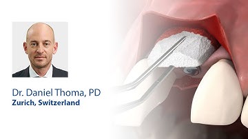 Case 1: Soft tissue augmentation around a dental implant