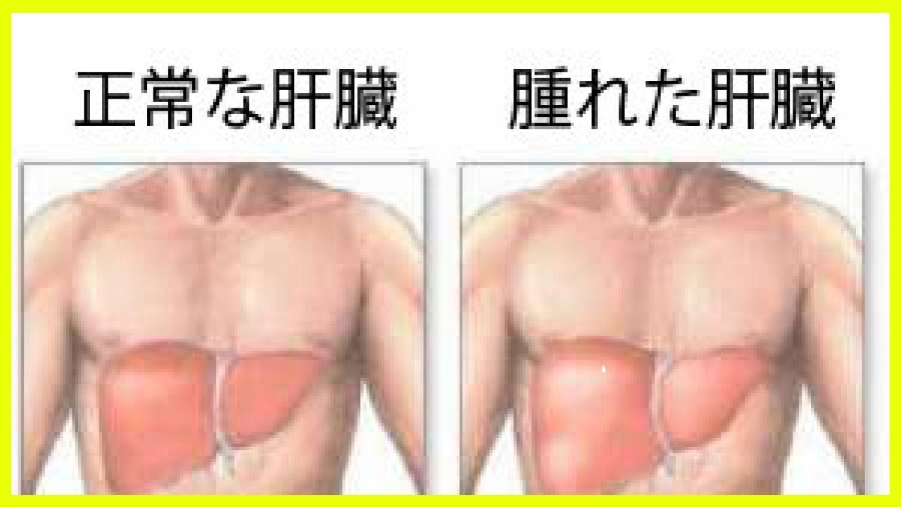 肝臓 が 腫れ て いる と 言 われ た