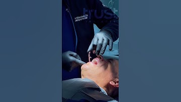 Why does a dentist need a torque wrench?