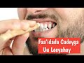 Faaidada cadeyga uu leeyahay  muuqaal aad kuu anfici doono