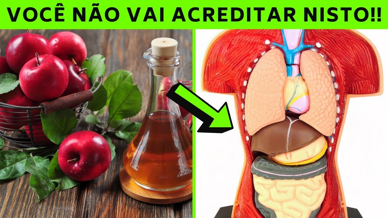 Quem tem gordura no fígado pode tomar vinagre de maçã?