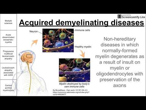Acquired demyelinating diseases