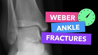 Weber Ankle Fractures - Radiopaedia's Emergency Radiology Course