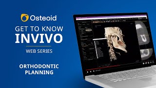 Webinar: Get to Know Invivo - Orthodontic Planning screenshot 3