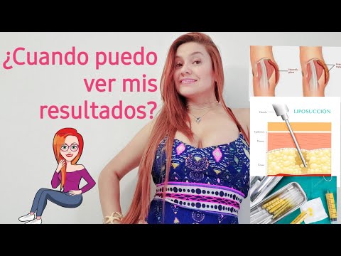 Video: ¿Cuánto tiempo se tarda en obtener los resultados de la CST?