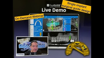 Single Implant Surgical Guide Design in RealGUIDE for DAS Guided Kit | Live Webinar by David Hsieh