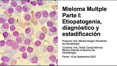 ¿Qué órganos se ven afectados por el mieloma?