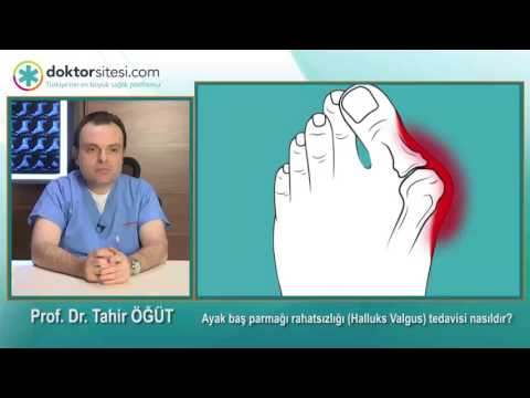Video: Ayak Parmaklarını Düzeltmenin 4 Yolu
