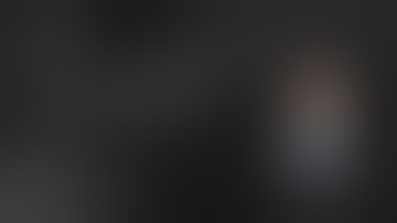 Scaphoid Excision and Arthrodesis With DynaNite® Staples and ArthroFLEX® Graft