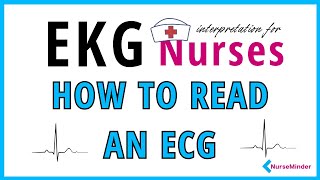 Introduction to ECG waveforms for Nurses