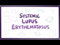 Lupus rythmateux systmique les  causes symptmes diagnostic et pathologie