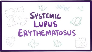Systemic lupus erythematosus (SLE) - causes, symptoms, diagnosis & pathology