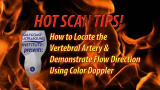 Hot Tip-How to Locate the Vertebral Artery and Demonstrate Flow Direction