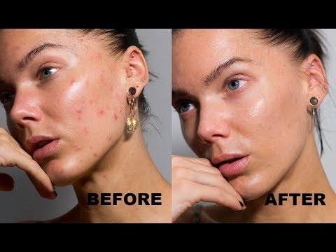 How To Cover Up Spots Without Covering Your Face & Some Self Love | Linda Hallberg Tutorials